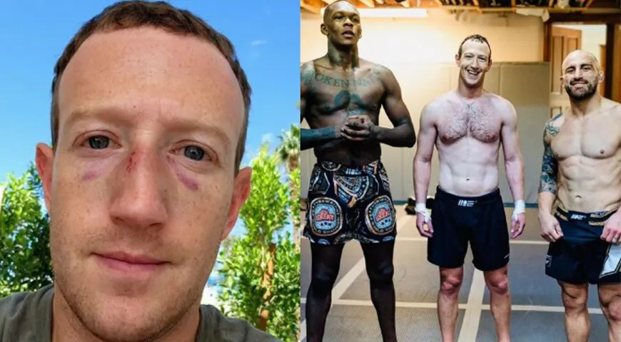Mark Zuckerberg Posted His Black Eyes After MMA Session. "Sparring Got Out Of Hand."