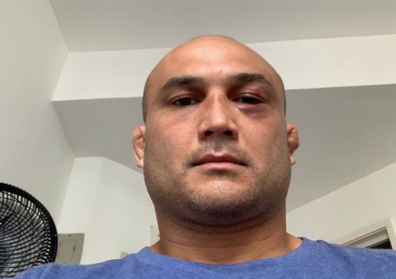B.J. Penn Shared: “CTE Is Fake, A Lie Used To Cover Up Murders”